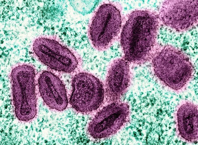 Monkeypox: Siamo di fronte all'ennesima emergenza globale? Monkeypox: Siamo di fronte all'ennesima emergenza globale?