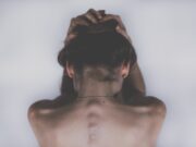 inestetismi